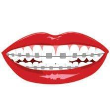 [Smile Assorted] Orthodontic Kits, 8-piece - Assorted, Smile with Braces